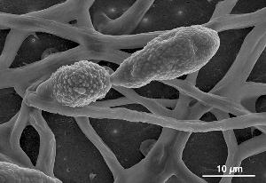 Scanning Electron Microscopy (SEM) image showing club-like conidia of Alternaria alternata strain SRC1lrK2f.