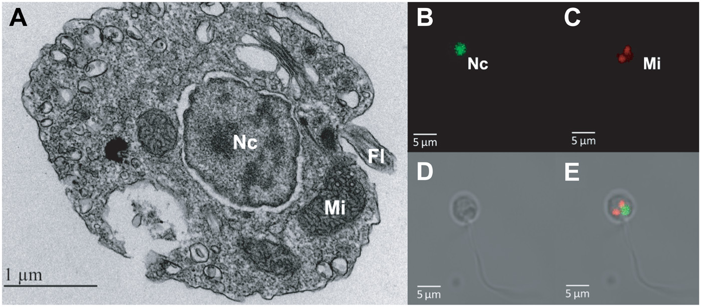 Amoebophrya ceratii