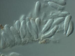 Aulographum hederae asci and ascospores