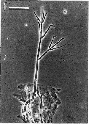 Asexual state of Clonostachys rosea showing a conidiophore with whirled phialdes and conidia (Rossman et al. 1999). 

