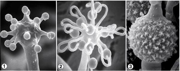 Figs 1 and 2) Few-spored sporangiola on long recurved pedicles (arising from a terminal vesicle). Fig 3) Darkly pigmented, ornamented zygospores produced by this self-fertile (homothallic) fungus. Images by Kerry O'Donnell.