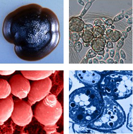 Representative images of black yeasts from the Broad Institute courtesy of Tadahiko Matsumoto, P. McIntosh, P. J. Szaniszlo, C. R. Cooper, Jr., J. D. Marlow, and M. J. Wheeler 