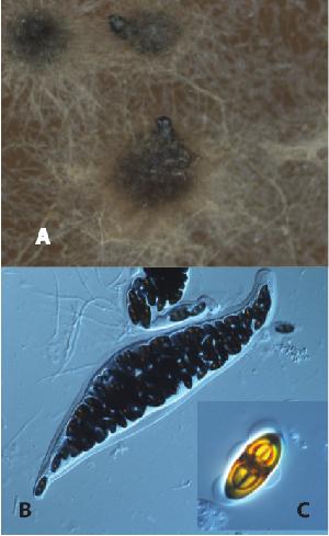 Delitschia confertaspora (ATCC 74209). A. Ascomata on V8 juice agar. B. 64-spored ascus. C. Ascospore.