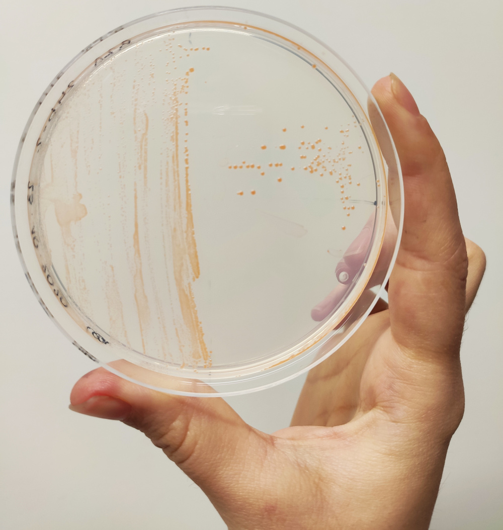 Dioszegia hungarica strain PDD-24b-2 grown on R2A plate at 17°C. 