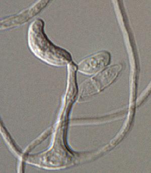 Conidiophores of Dissoconium aciculare, giving rise to conidia. 