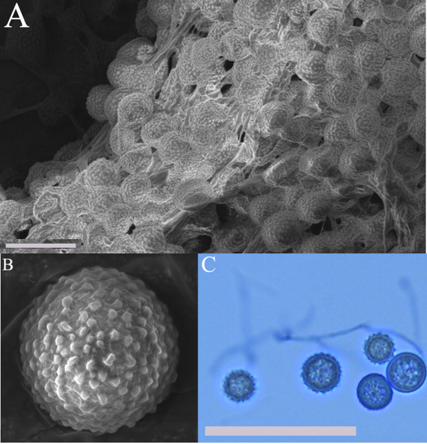 A. SEM image of chlamydospores and hyphae of Entomortierella lignicola NRRL 2525. Image taken using a Tescan MIRA3. Scale bar = 20 µm. Photo credit: Megan Korne (kornemeg@msu.edu), Alassane Sow (sowalass@msu.edu), and Per Askeland (askelano@egr.msu.edu). B. SEM image of the ornamentation present on a mature chlamydospore of Entomortierella lignicola NRRL 2525. Image taken using a Tescan MIRA3. Scale bar = 2 µm. Photo credit: Megan Korne (kornemeg@msu.edu), Alassane Sow (sowalass@msu.edu), and Per Askeland (askelano@egr.msu.edu). C. Chlamydospores of Entomortierella lignicola NRRL 2525 stained with lactophenol cotton blue under 100x magnification. Scale bar = 50 µm. Photo credit: Megan Korne (kornemeg@msu.edu) and Alassane Sow (sowalass@msu.edu).