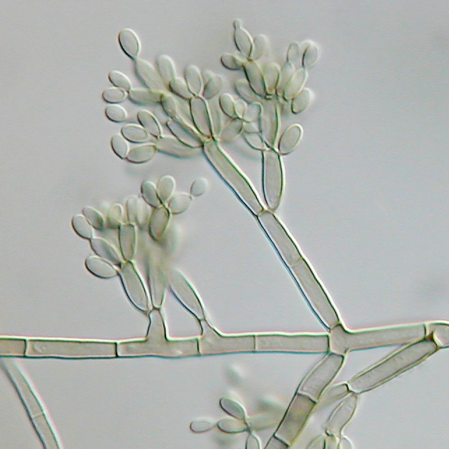  Conidiophores of Fonsecaea pedrosoi.
Image by James Scott, photographed in Nomarski Differential Interference Contrast microscopy at 500X from slide culture of Fonsecaea pedrosoi grown on Modified Leonian's agar. 