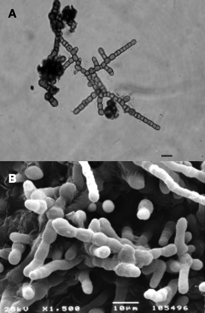 Photo of Friedmanniomyces endolithicus CCFEE 5311