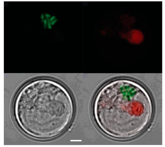 Condensed chromosomes in an interphase S. kawagutii cell. A
confocal image of a single cell taken in (upper left) the green
channel (PI staining of chromosomes), (upper right) the red channel
(natural chlorophyll fluorescence), and (lower left) a DIC
(Nomarski) image (scale bar 1 &micro;m for all panels). A merged
image is shown in the lower right. Image from <a href="https://doi.org/10.3390/microorganisms7080261">Zaheri et al</a> under CC-BY 4.0