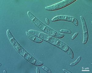 Macroconidia and microconidia of Fusarium vanettenii. 