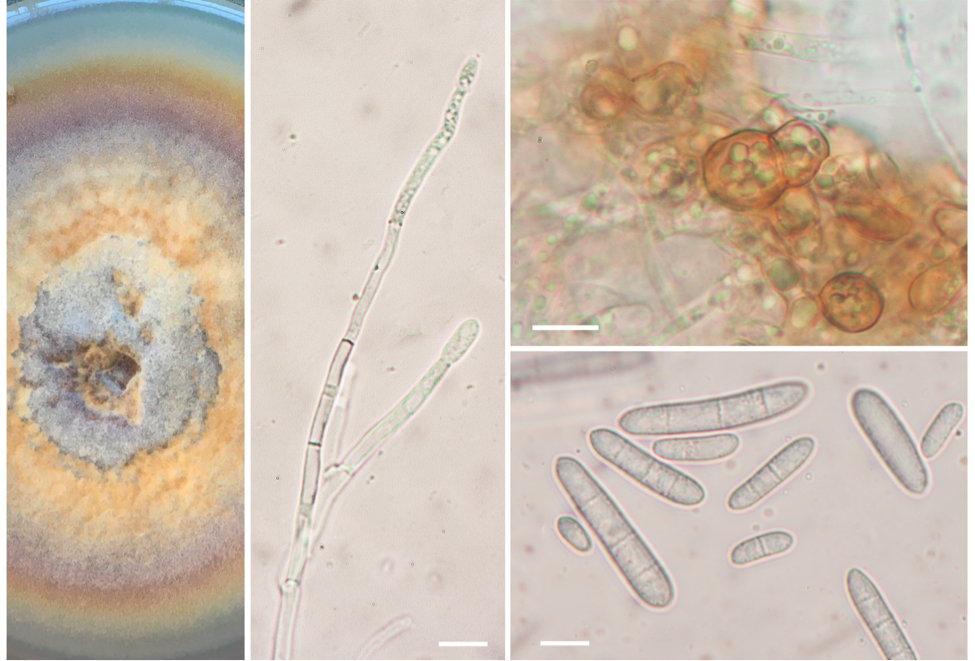 Ilyonectria robusta PMI_751 (1113390)