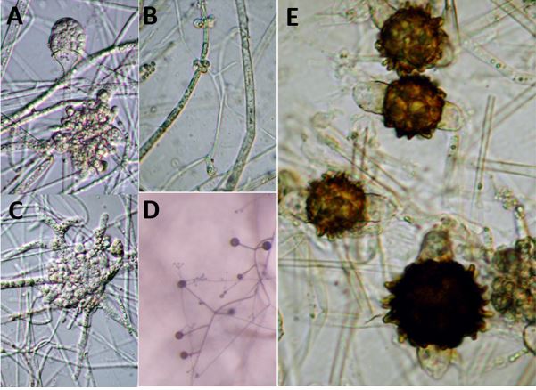 Fig. A. Congeneric <a
href="https://mycocosm.jgi.doe.gov/Lenpar1">Lentamyces parricidus </a> (Benny s116) sporangium and a large
multilobed gall where it is infecting the host Absidia. Fig. B.
Lentamyces parricidus (Benny s116) showing an early stage of gall
formation where it is infecting the host Absidia. Fig. C.
Lentamyces parricidus (Benny s116) showing a very large multilobed
gall where it is infecting the host Absidia. Fig. D. Lentamyces
parricidus (Benny s116) (fungus with the finer hyphae) parasitizing
a host fungus in the genus Absidia (fungus with thicker hyaphe).
Fig. E. Lentamyces parricidus (Benny s116) showing several
zygospores and the small hemi-sphaerical suspensors. Images by
Gerald Benny available on <a
href="http://zygomycetes.org/index.php?id=158">Zygomycetes.org
Lentamyces page.</a>