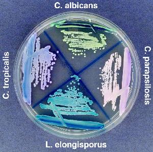 Photo of Lodderomyces elongisporus NRRL YB-4239