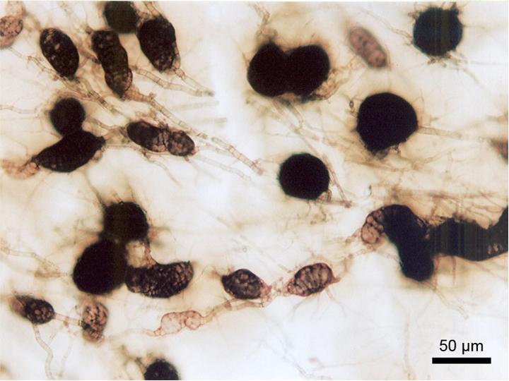 Sclerotia of Macrophomina phaseolina.