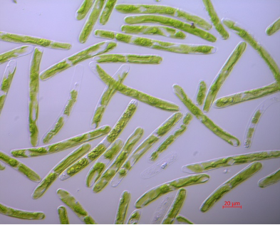 Photo of Mesotaenium kramstae NIES-658 in liquid culture [Image credit: Xuehuan Feng]