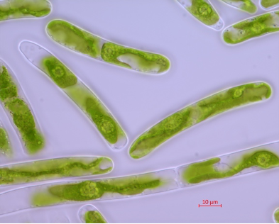 Photo of Mesotaenium kramstae NIES-658 in liquid culture [Image credit: Xuehuan Feng]