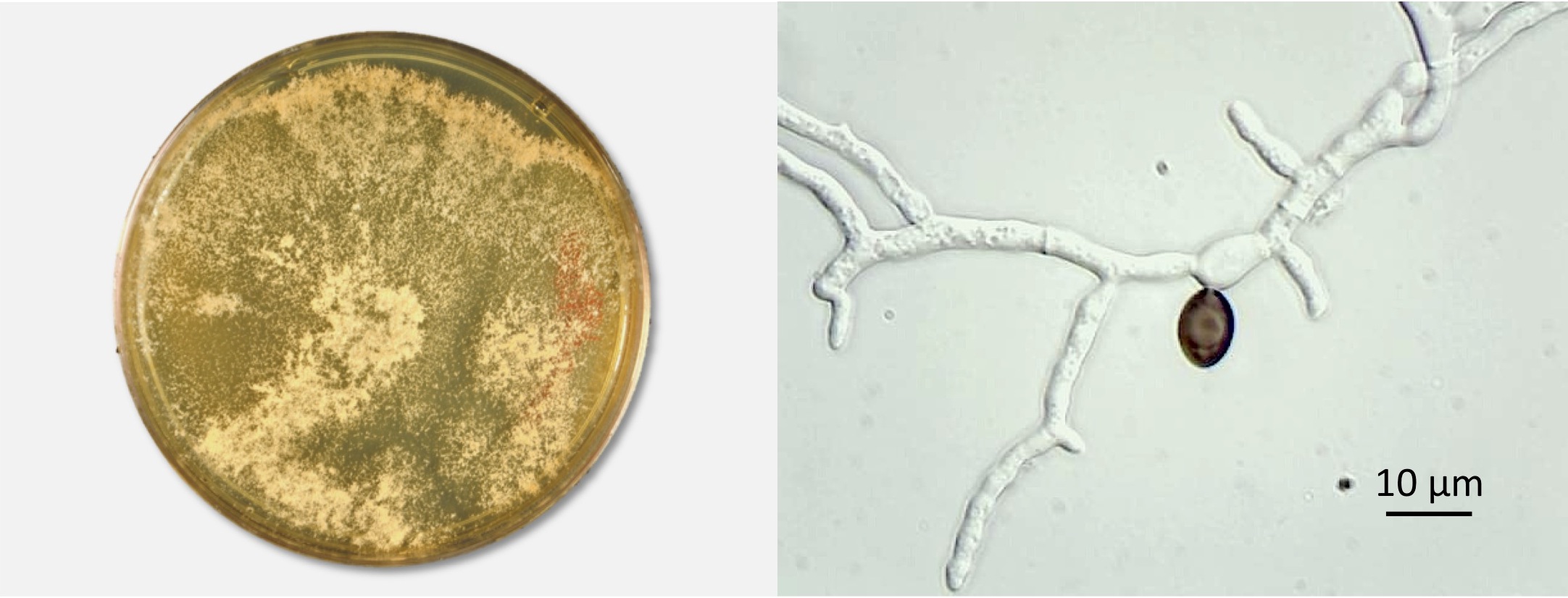 Conidiating colony on MEA and germinating ascopore. Photos by Don Natvig and Miriam Hutchinson
