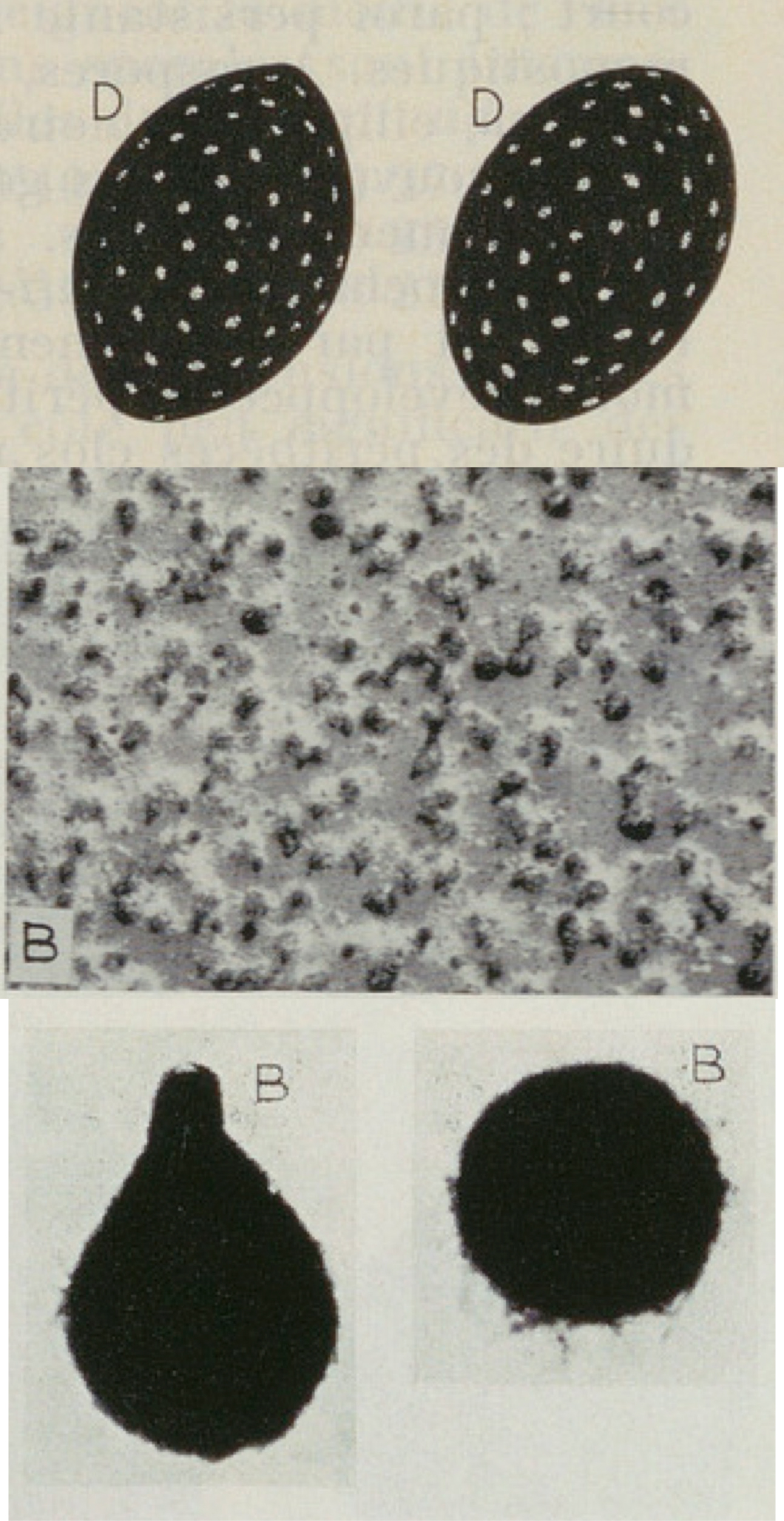 Perithecia and ascospores of Neurospora seminuda 