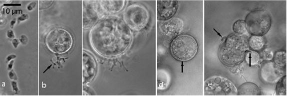 Images of Paraphysoderma strain JEL821:
a) Amoeboid spores.
b) Developing sporangium with filamentous rhizoids (arrow) in pure culture. 
c) Later stage of sporangial development.
d) Thick-walled (arrow) resting spore.
e) Early germination stage of resting spore. Note walls have curled back (arrows) and endosporangium is beginning to emerge (compare with Physoderma germination (Figs. 3, 4. Sparrow et al. 1961).
Photos by Joyce E. Longcore.