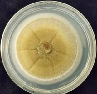 Phoma multirostrata on PDA plate.