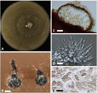 Coniella lustricola A) Culture on potato dextrose agar, B) Conidioma on agar supplemented with Miscanthu sp., C) Cross section of conidioma, D) Conidiogenous cells with conidia, D) Mature conidia. Scale bars: B=175µm, C=60µm, and D,E=10µm.  Photographs: Daniel Raudabaugh and Teresa Iturriaga