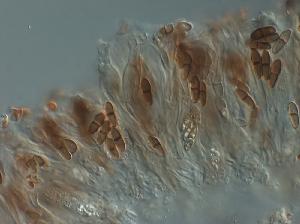 Hymenium layer with asci and ascospores