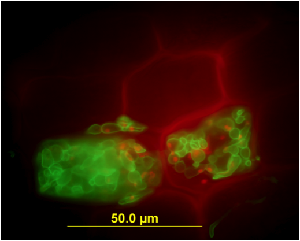 Sebacina vermifera