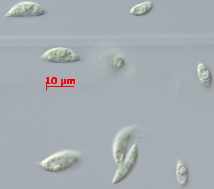 Photo of Tetradesmus deserticola SNI-2 v1.1