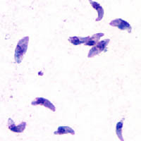 Toxoplasma gondii