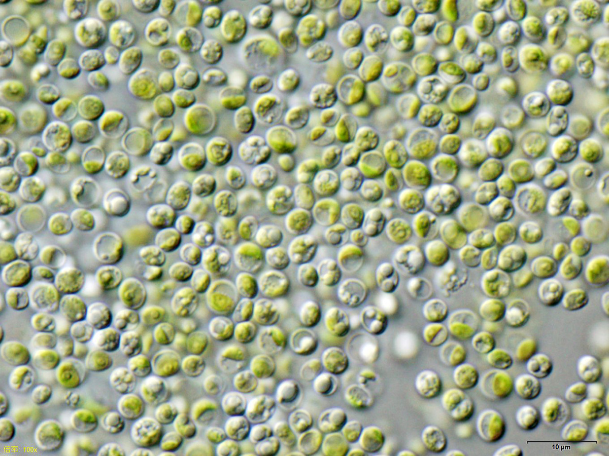 Trebouxiophyceae example species Chlorella vulgaris NIES-2170 [Image credit: User:NEON / User:NEON_ja, <a href="https://creativecommons.org/licenses/by-sa/3.0" target=_new>CC BY-SA 3.0</a>, via <a href="https://commons.wikimedia.org/wiki/File:Chlorella_vulgaris_NIES2170.jpg" target=_new>Wikimedia Commons</a>]