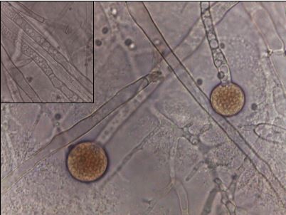 Mycelium of Umbelopsis sp. nov. AD052 grown on malt extract agar (MEA) seen on light microscopy. Umbelopsis sp. nov. AD052 has a coenocytic mycelium with few septa. The cytoplasm is rich in lipid bodies of different dimensions (inset). Sporangiospores are produced in terminal multispored sporangia. Image by Alessandro Desirò.