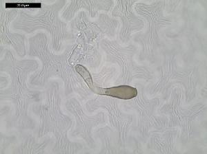 Venturia inaequalis infection of apple leaf (2 days post inoculation) showing germinated  conidium and development of early stage, subcuticular stroma. 